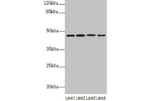 Western blot All lanes: NAPEPLD antibody at 6 μg/mL Lane 1: Mouse large intestine tissue Lane 2: Mouse kidney tissue Lane 3: Mouse stomach tissue Lane 4: MCF-7 whole cell lysate Secondary Goat polyclonal to rabbit IgG at 1/10000 dilution Predicted band size: 46 kDa Observed band size: 46 kDa (NAPEPLD antibody  (AA 1-200))