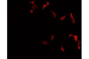 ABIN6277998 staining HepG2? (NR4A1 antibody  (Internal Region))
