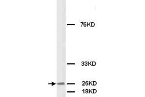 Western Blot analysis of FGF8 expression from MCF-7 cell lyate with FGF8 polyclonal antibody .