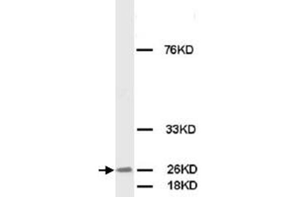 FGF8 anticorps  (C-Term)