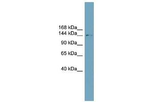 SLC4A2 antibody used at 1 ug/ml to detect target protein. (SLC4A2 antibody  (N-Term))