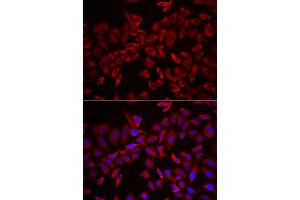 Immunofluorescence analysis of HeLa cells using CSRP3 antibody (ABIN6291316). (CSRP3 antibody)