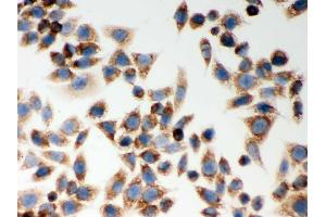IHC analysis of CARD4  using anti-CARD4  antibody . (NOD1 antibody  (AA 1-160))
