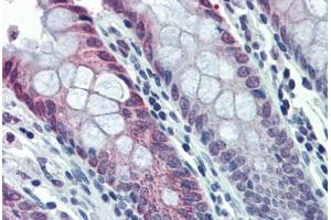 Human Colon: Formalin-Fixed, Paraffin-Embedded (FFPE) (HDAC2 antibody  (N-Term))