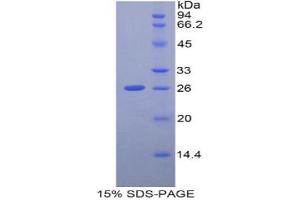 SDS-PAGE (SDS) image for Glutamate-Cysteine Ligase, Catalytic Subunit (GCLC) (AA 429-637) protein (His tag) (ABIN1878121) (GCLC Protein (AA 429-637) (His tag))