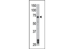 Image no. 2 for anti-TXK tyrosine Kinase (TXK) (N-Term) antibody (ABIN359999) (TXK antibody  (N-Term))
