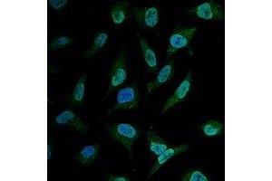 Immunofluorescent analysis of BCL2 staining in Hela cells. (Bcl-2 antibody)
