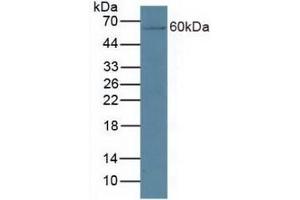 Detection of CYP27B1 in Mouse Kidney Tissue using Polyclonal Antibody to Cytochrome P450 27B1 (CYP27B1) (CYP27B1 antibody  (AA 251-500))