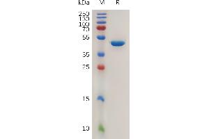 SDS-PAGE (SDS) image for Anterior Gradient Homolog 2 (Xenopus Laevis) (AGR2) (AA 21-175) protein (Fc Tag) (ABIN7491091)