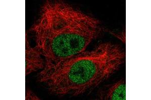 Immunofluorescent staining of A-549 cells with ZEB1 monoclonal antibody, clone CL0151  (Green) shows nuclear (without nucleoli).