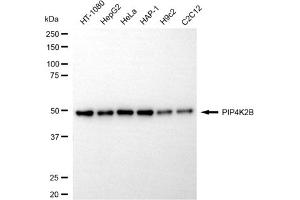 anti-Phosphatidylinositol-5-Phosphate 4-Kinase, Type II, beta (PIP4K2B) antibody