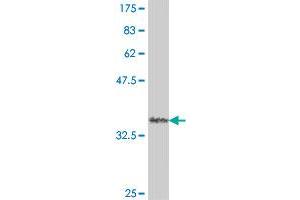 Western Blot detection against Immunogen (33. (KCNE1 antibody  (AA 67-129))