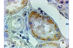 ABIN4902506 (2µg/ml) staining of paraffin embedded Human Kidney. (AADAT antibody)