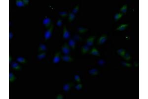 Immunofluorescence staining of Hela cells with ABIN7158896 at 1:50, counter-stained with DAPI. (MST1R antibody  (AA 1175-1400))