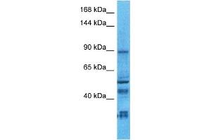 Host:  Rabbit  Target Name:  NLGN2  Sample Type:  Uterus Tumor lysates  Antibody Dilution:  1. (Neuroligin 2 antibody  (C-Term))