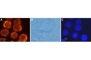 Expression of OX2R in human colon cancer cells - Immunocytochemical staining of paraformaldehyde-fixed and permeabilized human Colo-205 colon cancer cells using Anti-Orexin Receptor 2 Antibody (ABIN7043029, ABIN7044885 and ABIN7044886), (1:500), followed by goat-anti-rabbit-AlexaFluor-555 secondary antibody (red). (CD200R1 antibody  (C-Term, Intracellular))