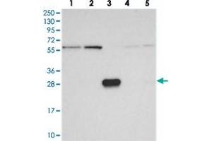 Western blot analysis of Lane 1: RT-4, Lane 2: U-251 MG, Lane 3: Human Plasma, Lane 4: Liver, Lane 5: Tonsil with KIAA1128 polyclonal antibody  at 1:250-1:500 dilution. (FAM190B antibody)