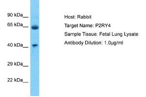 Host: Rabbit Target Name: P2RY4 Sample Type: Fetal Lung lysates Antibody Dilution: 1. (P2RY4 antibody  (C-Term))