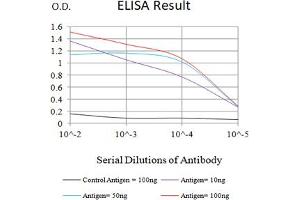 Black line: Control Antigen (100 ng),Purple line: Antigen (10 ng), Blue line: Antigen (50 ng), Red line:Antigen (100 ng) (SARS-CoV-2-NP3 (AA 240-419) antibody)