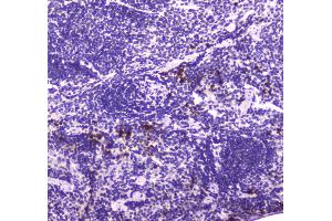 Immunohistochemistry (IHC) image for anti-Lactotransferrin (LTF) (AA 529-710) antibody (ABIN5693189)