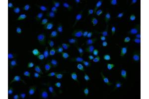 IF analysis of Neuropilin 1 using anti-Neuropilin 1 antibody (ABIN7601921). (Neuropilin 1 antibody  (AA 504-827))