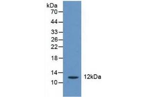 Detection of CRADD in Human Liver Tissue using Polyclonal Antibody to CASP2 And RIPK1 Domain Containing Adaptor With Death Domain Protein (CRADD) (CRADD antibody  (AA 1-199))