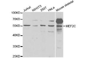 Western blot analysis of extracts of various cell lines, using MEF2C antibody. (MEF2C antibody  (AA 170-380))