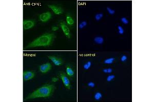 ABIN6391342 Immunofluorescence analysis of paraformaldehyde fixed U251 cells, permeabilized with 0. (IFT74 antibody)