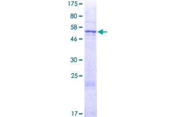 TAM41 Protein (AA 1-316) (GST tag)