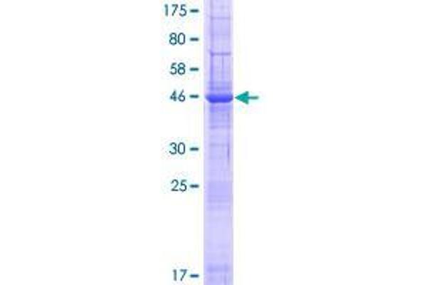 ARL6IP6 Protein (AA 1-226) (GST tag)