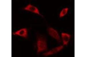 ABIN6275523 staining Hela cells by IF/ICC. (Septin 6 antibody  (Internal Region))