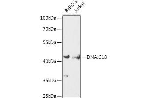 Western blot analysis of extracts of various cell lines, using DN antibody (ABIN7266825) at 1:1000 dilution. (DNAJC18 antibody  (AA 260-350))