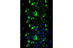 Immunofluorescence analysis of U2OS cells using GZMB antibody. (GZMB antibody  (AA 148-247))