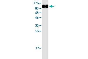 Image no. 1 for Melanoma Cell Adhesion Molecule (MCAM) (AA 24-646) protein (His-DYKDDDDK-Strep II Tag) (ABIN2752854) (MCAM Protein (AA 24-646) (His-DYKDDDDK-Strep II Tag))