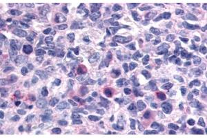 Anti-CXCR1 antibody  ABIN1048469 IHC staining of human lymph node. (CXCR1 antibody  (N-Term))