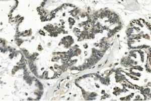 IHC analysis of PHEX using anti-PHEX antibody (ABIN7600072). (PHEX antibody  (AA 145-718))
