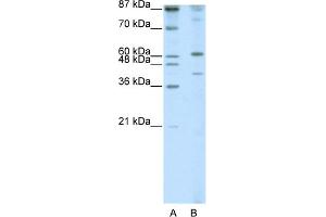 WB Suggested Anti-REXO4 Antibody Titration:  1. (REXO4 antibody  (N-Term))