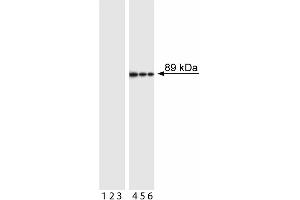 Western blot analysis of PARP (cleavage site-specific). (PARP1 antibody  (Asp214, cleaved))