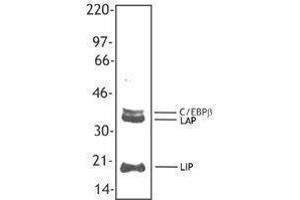 Western Blotting (WB) image for anti-CCAAT/enhancer Binding Protein (C/EBP), beta (CEBPB) antibody (ABIN2664082) (CEBPB antibody)