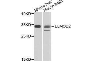 Western blot analysis of extracts of mouse liver and moues brain using ELMOD2 antibody. (ELMOD2 antibody)