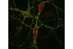 Immunocytochemistry (ICC) image for anti-GABA Transporter 1 (GAT1) (AA 585-599) antibody (ABIN1742535) (SLC6A1 antibody  (AA 585-599))