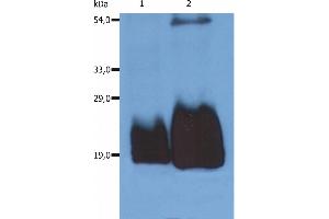 Western Blotting analysis (non-reducing conditions) of whole cell lysate of HPB-ALL human peripheral blood T cell leukemia cell line using anti-CD59 (MEM-43/5). (CD59 antibody)