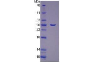 SDS-PAGE analysis of Mouse PYGM Protein. (PYGM Protein)
