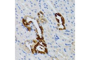 Immunohistochemistry of paraffin-embedded mouse kidney using GRB2 antibody. (GRB2 antibody  (AA 1-217))