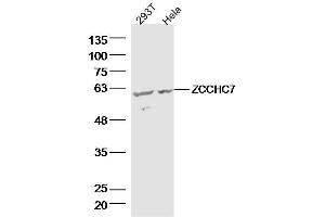 Lane 1: 293T lysates Lane 2: hela lysates probed with ZCCHC7 Polyclonal Antibody, Unconjugated  at 1:300 dilution and 4˚C overnight incubation.