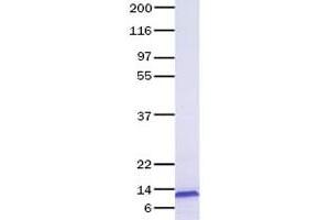 Validation with Western Blot (CCL7 Protein)