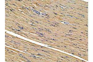 ABIN7095504 and ABIN7099561 at 1/100 staining rat muscle tissue by IHC-P. (VMP1 antibody)