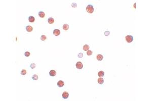 Immunohistochemistry (IHC) image for anti-Placenta-Specific 4 (PLAC4) (Middle Region) antibody (ABIN1031043) (PLAC4 antibody  (Middle Region))