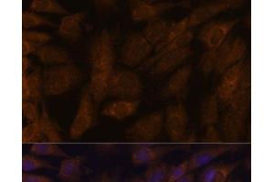 Immunofluorescence analysis of C6 cells using TXNRD1 Polyclonal Antibody at dilution of 1:100. (TXNRD1 antibody)