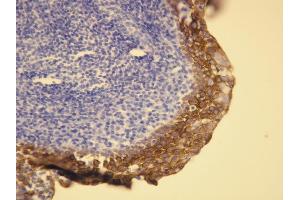 Immunohistochemistry (IHC) image for anti-Keratin 5/6 (KRT5/6) (AA 548-564), (C-Term) antibody (ABIN7598763) (Keratin 5/6 antibody  (C-Term))